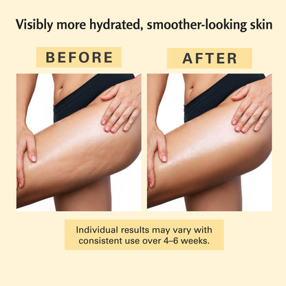 Anti Cellulite Massage Oil, Firming Body Care